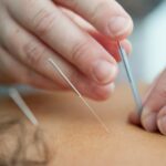 Acupunctuur in Breda: zo vind je een goede acupuncturist die bij je past